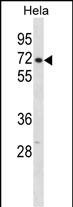 WB - CPSF6 Antibody (N-term) AP20278a